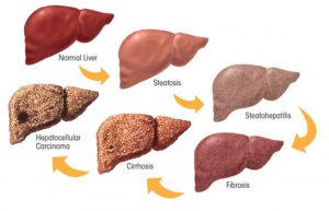 liver